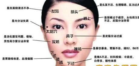 揭秘脸上各个部位长痘的原因 对症下药祛痘更有效